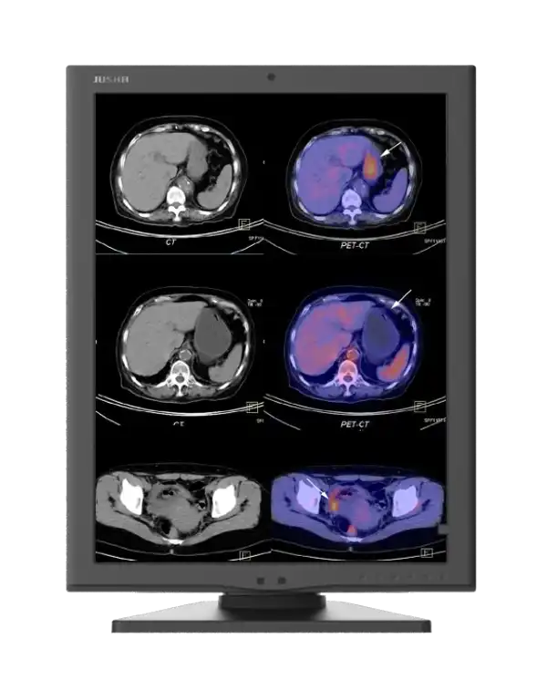 Diagnostický monitor JUSHA C270G nebo M270G