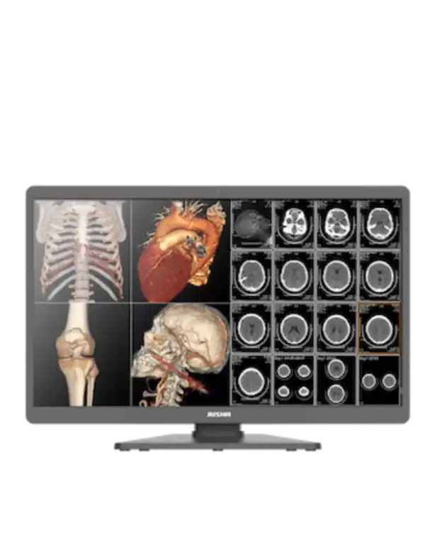 Barevný diagnostický monitor JUSHA C820G